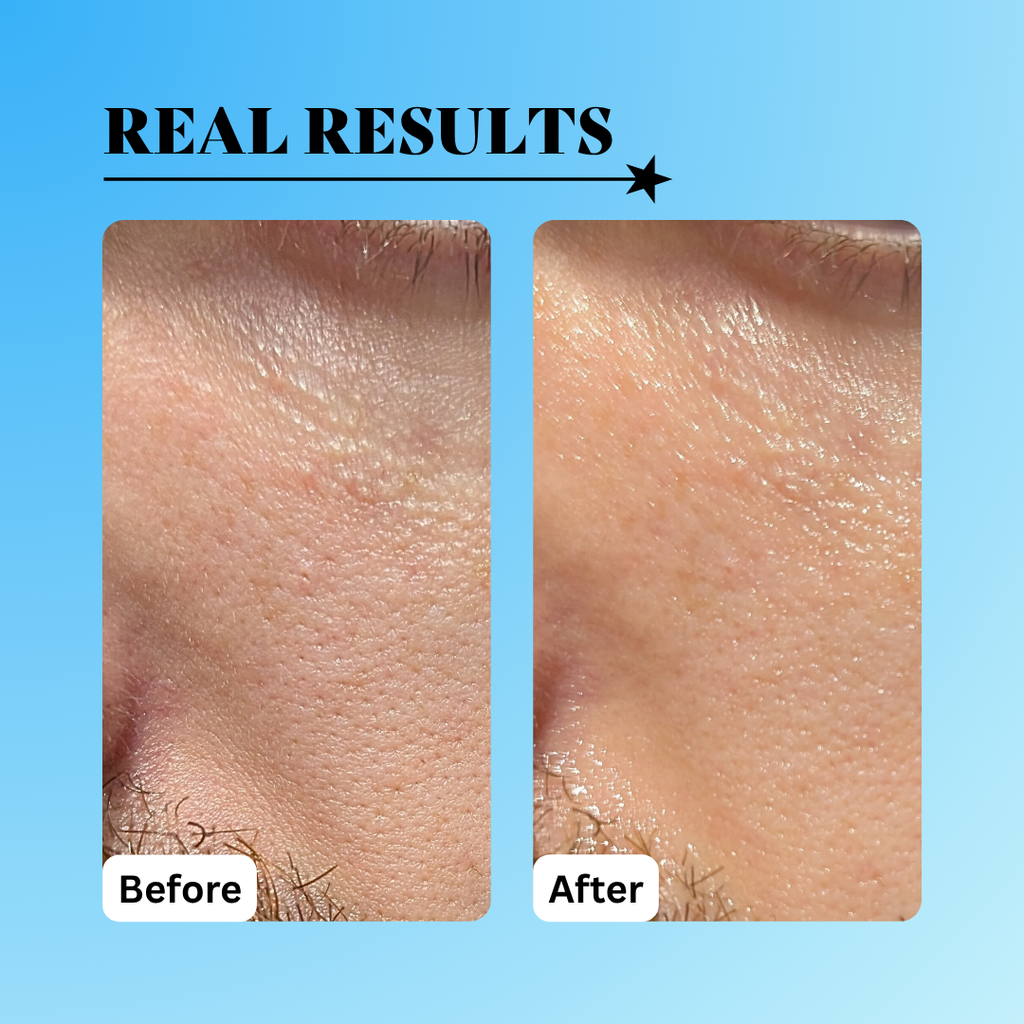 Radical Replenishment Hydration Serum