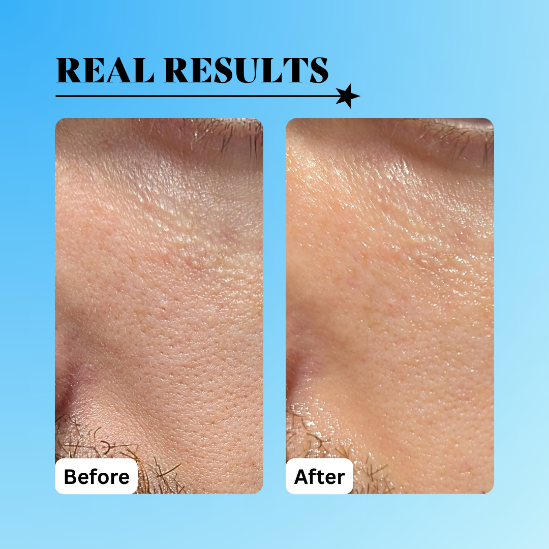 Radical Replenishment Hydration Serum