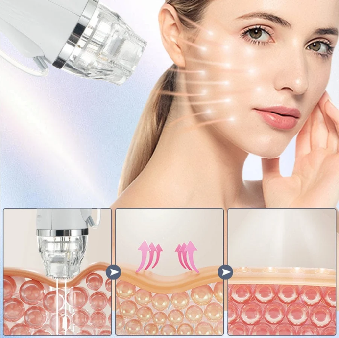 Shape Tactics Advanced Gold Micro Crystal RF System with Cold Hammer Technology