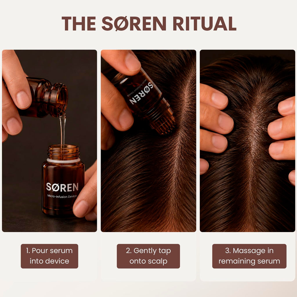 SØREN Micro Infusion Hair Renewal System by SOREN - Saw Palmetto & Peptide Scalp Treatment Kit | Supports Fuller, Thicker-Looking Hair | Gold Microinfuse Applicator (3 Month Supply)