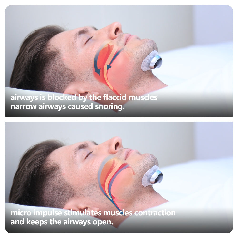 Smart Anti-Snoring Device Electronic Muscle Stimulator