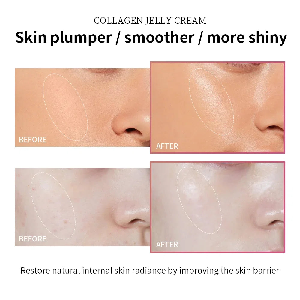 Lakerain Anti Aging Collagen Jelly Cream With Niacinamide Moisturizer