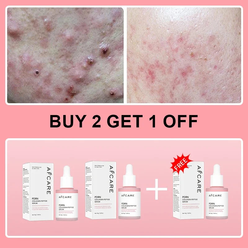 Collagen Peptide Facial Serum Targets Dull Skin Boosts Skin Elasticity Stimulates Skin Renewal Repair Salmon PDRN KOREAN Product