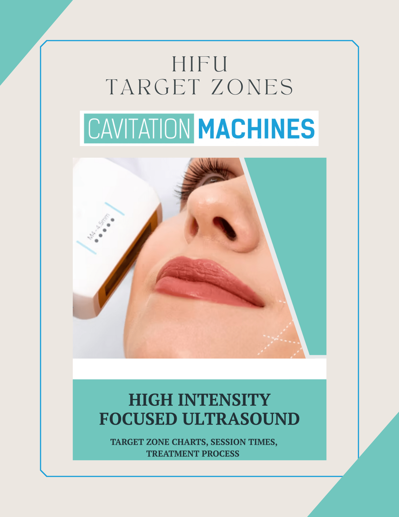 Shape Tactics HIFU Target Zone Chart