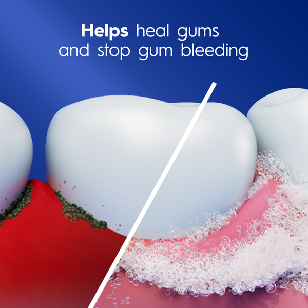 Crest Pro-Health Gum & Sensitive Toothpaste - Sensitivity Toothpaste