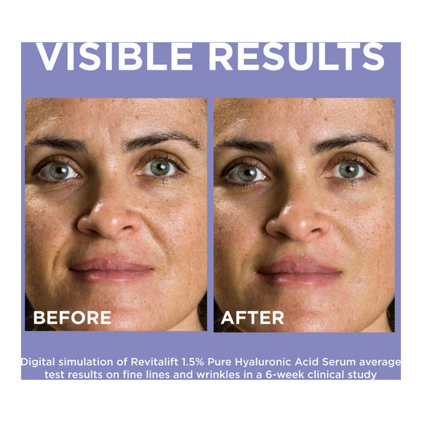 L'Oreal Derm Intensives Hyaluronic Acid Face Serum,