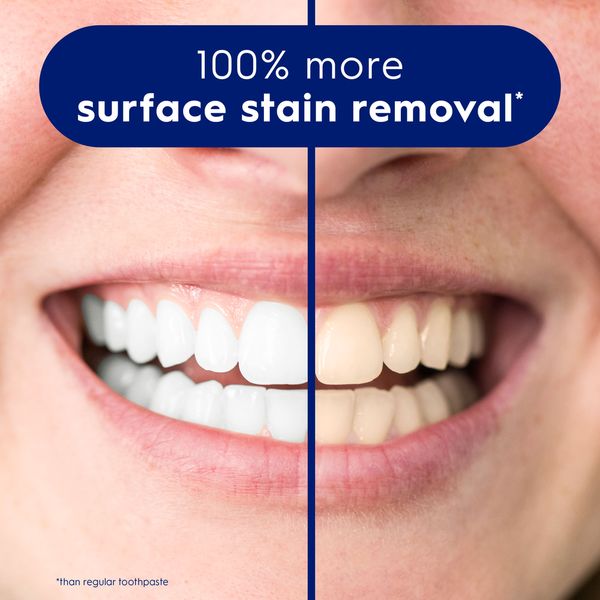 Crest 3D White Brilliance Vibrant Peppermint Teeth Whitening Toothpaste
