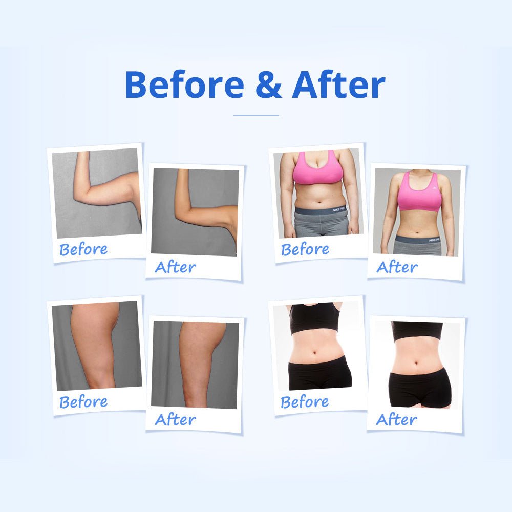Shape Tactics 5-in-1 RF & 40K Cavitation Contouring System
