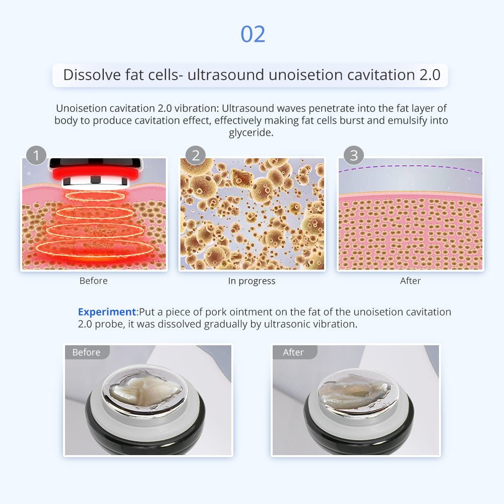 Shape Tactics 5-in-1 Unoisetion Vacuum RF System