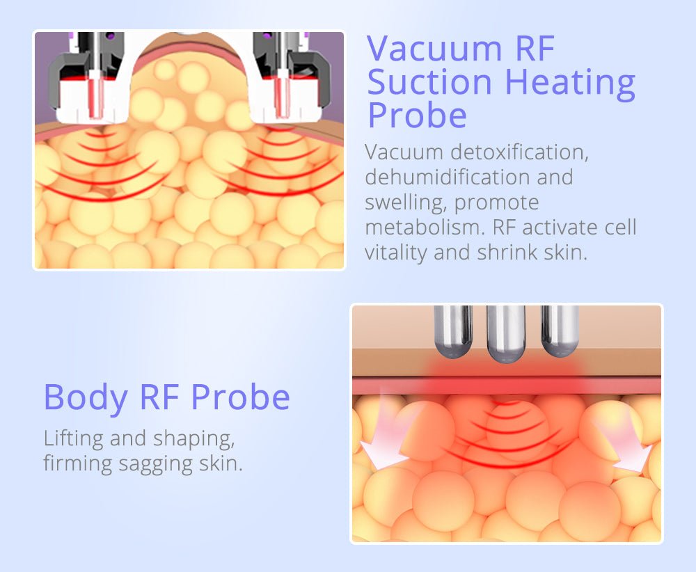 Shape Tactics 9-in-1 Smart RF 3D Cavitation System