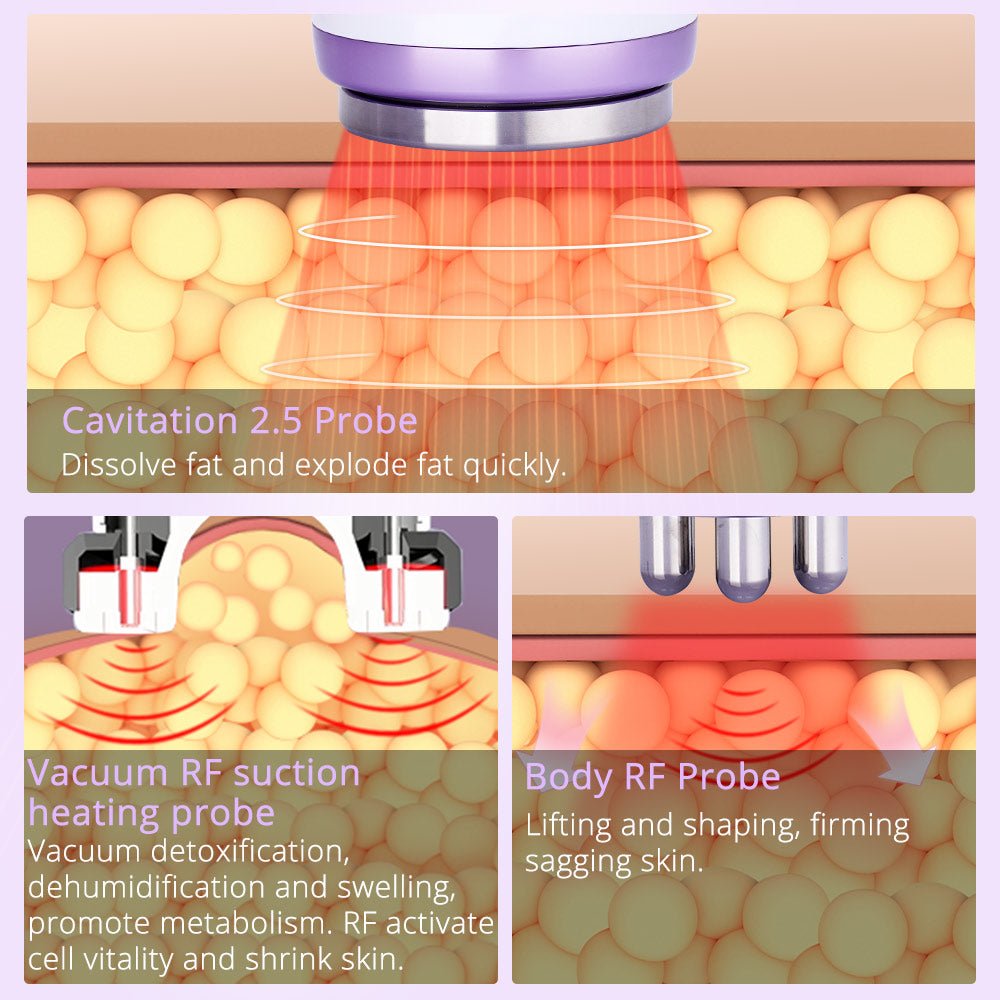 Shape Tactics 5-in-1 Cavitation Vacuum RF Body Contouring System