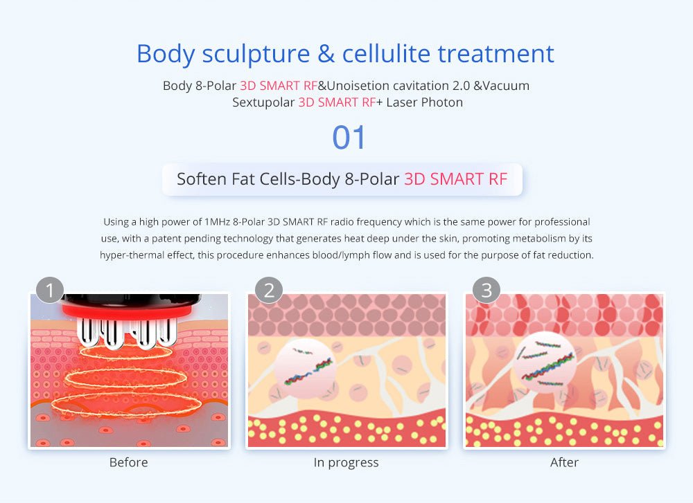 Shape Tactics Advanced 8-in-1 Unoisetion Cavitation & RF System with LED Laser Pads