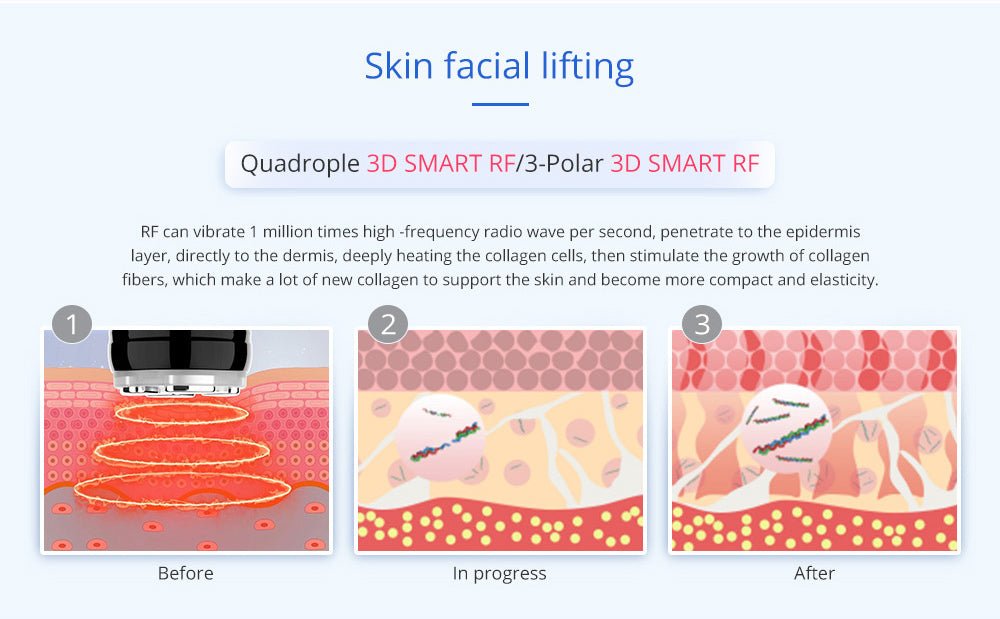 Shape Tactics Advanced 8-in-1 Unoisetion Cavitation & RF System with LED Laser Pads