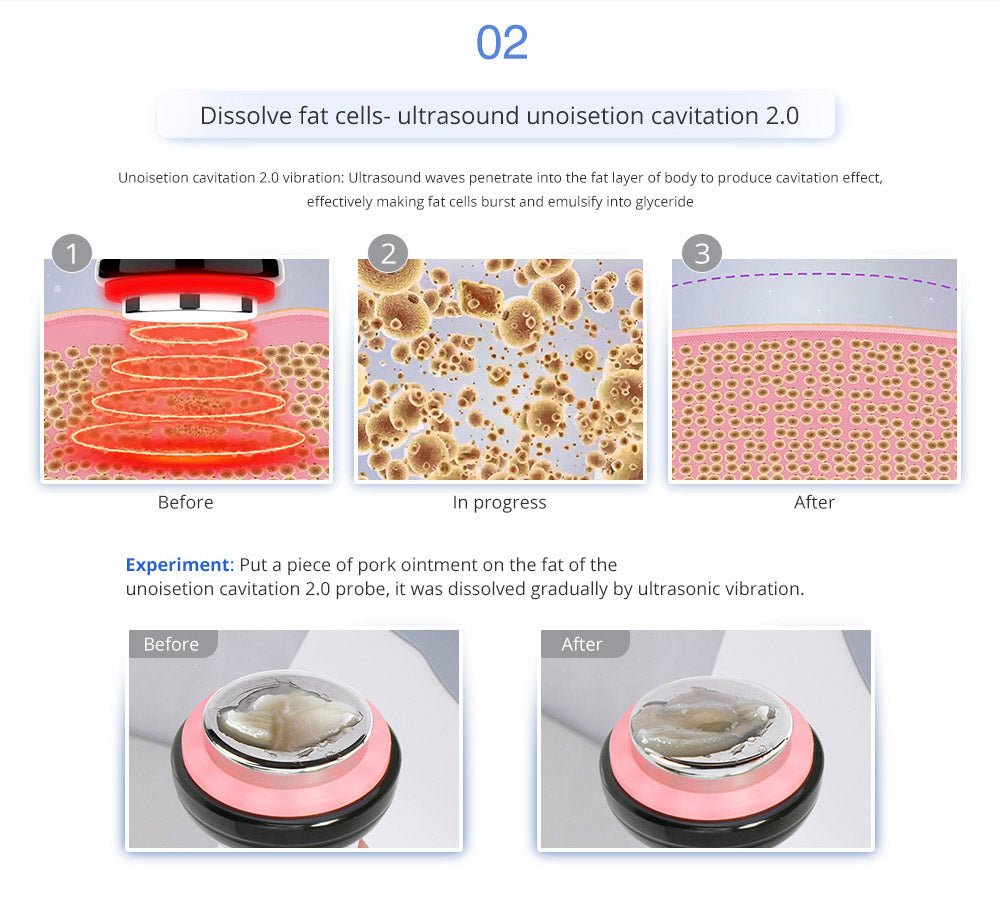 Shape Tactics Advanced 8-in-1 Unoisetion Cavitation & RF System with LED Laser Pads