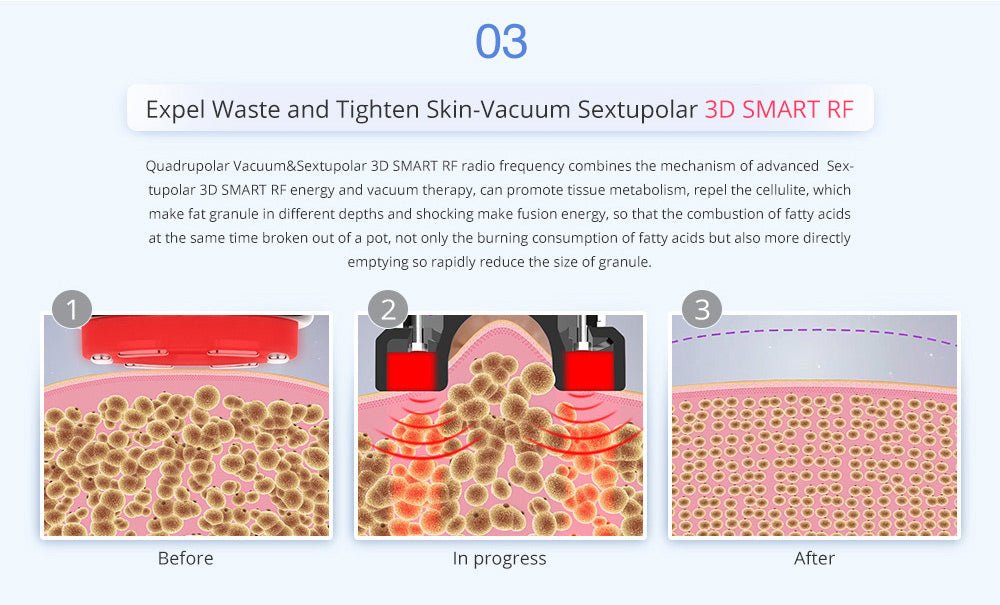 Shape Tactics Advanced 8-in-1 Unoisetion Cavitation & RF System with LED Laser Pads