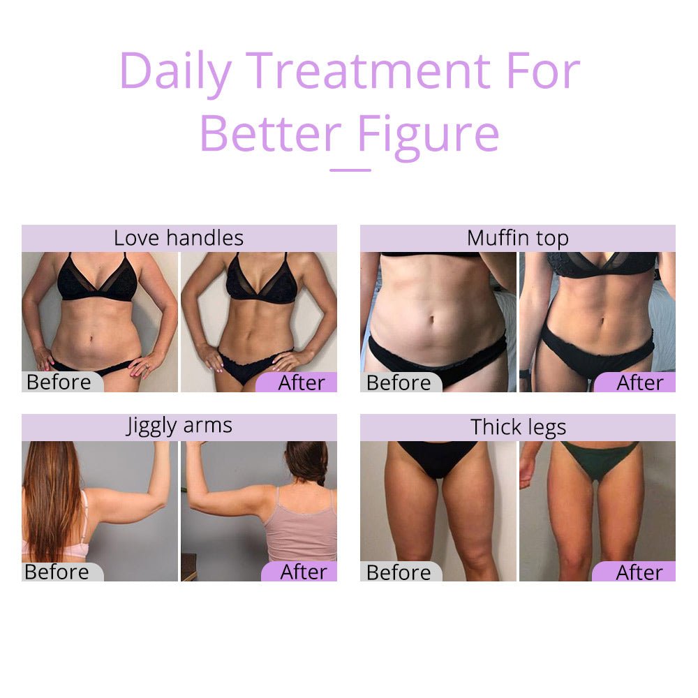 Shape Tactics Unoisetion 2.5 Ultrasonic Cavitation System